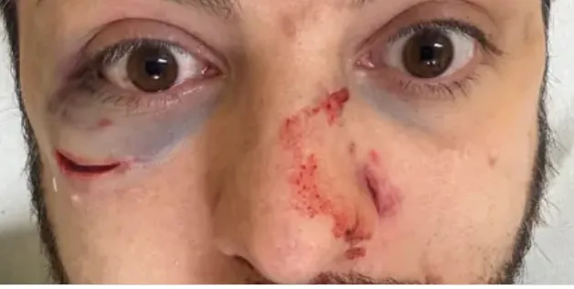 Filma i truffatori delle Tre Campanelle al centro della capitale: l’influencer Guardian of Rome picchiato a sangue
